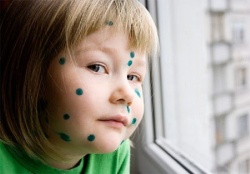 Зеленка — незаменимый антисептик